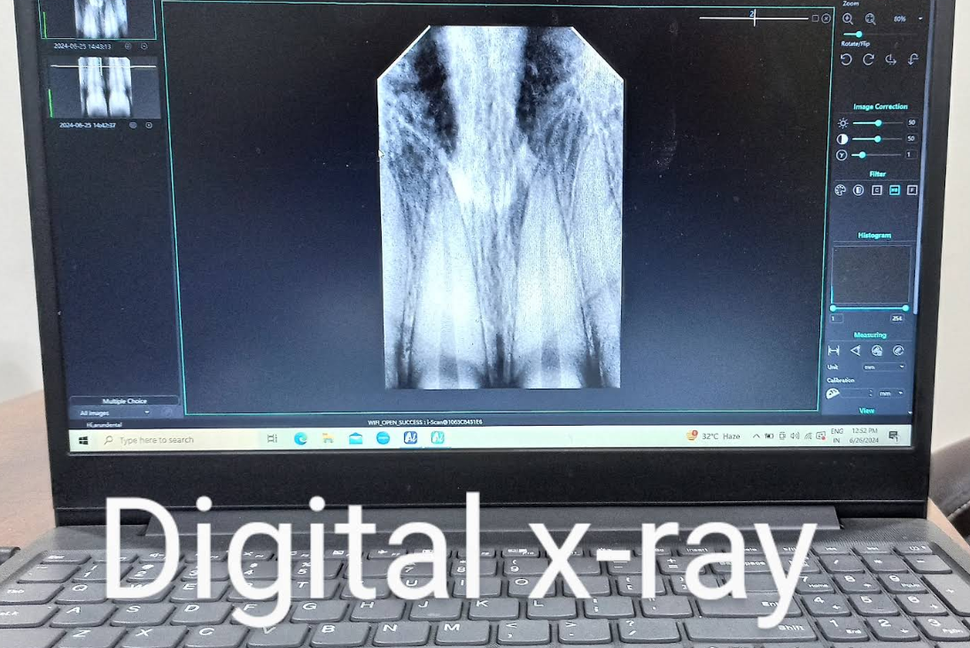 Digital X-ray technology